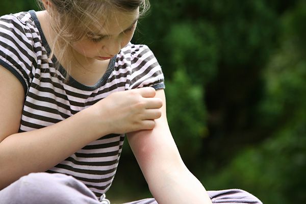 trị muỗi đốt, MosquitoMagnet.com